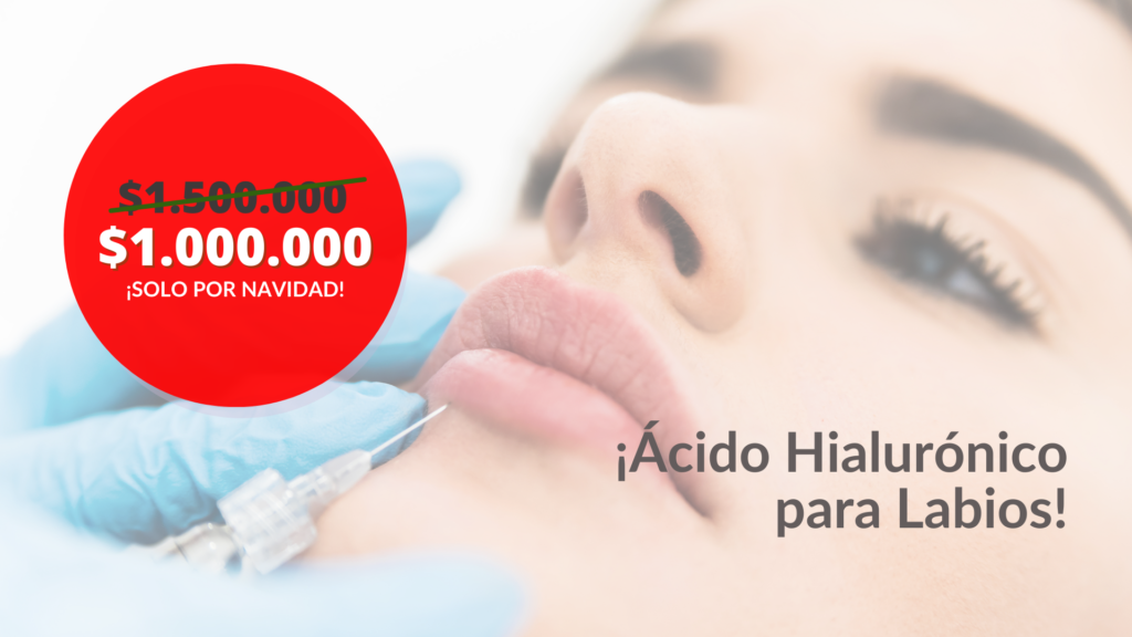 promoción de ácido hialurónico para labios en bogotá