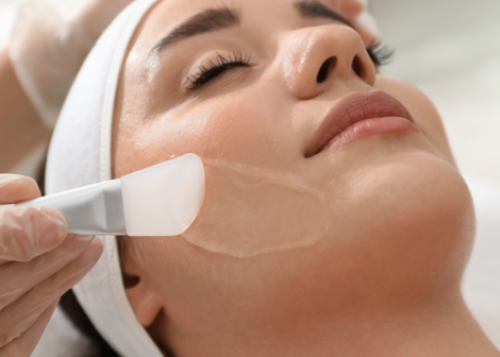 ¿Cada Cuánto Debo Hacerme un Peeling Facial?