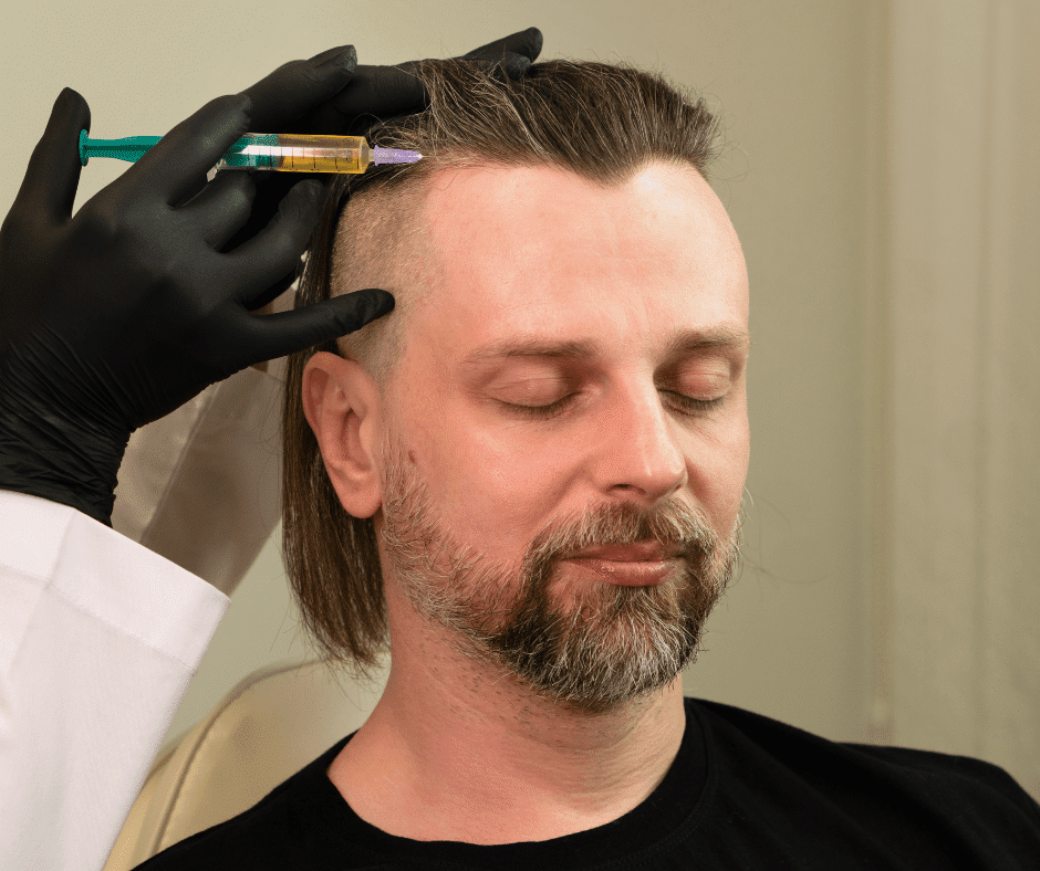 4 Main Benefits of Platelet-Rich Plasma for Hair