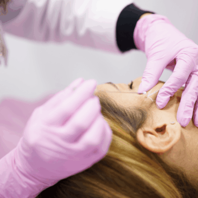 Get ready for your Eye Thread Lift treatment