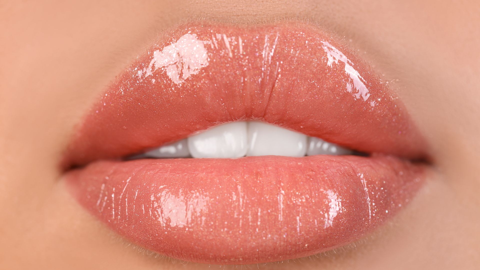 Tratamiento de labios con ácido hialurónico