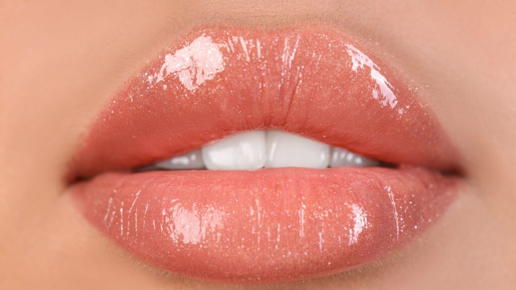 Labios con ácido hialurónico Monreal Bogotá