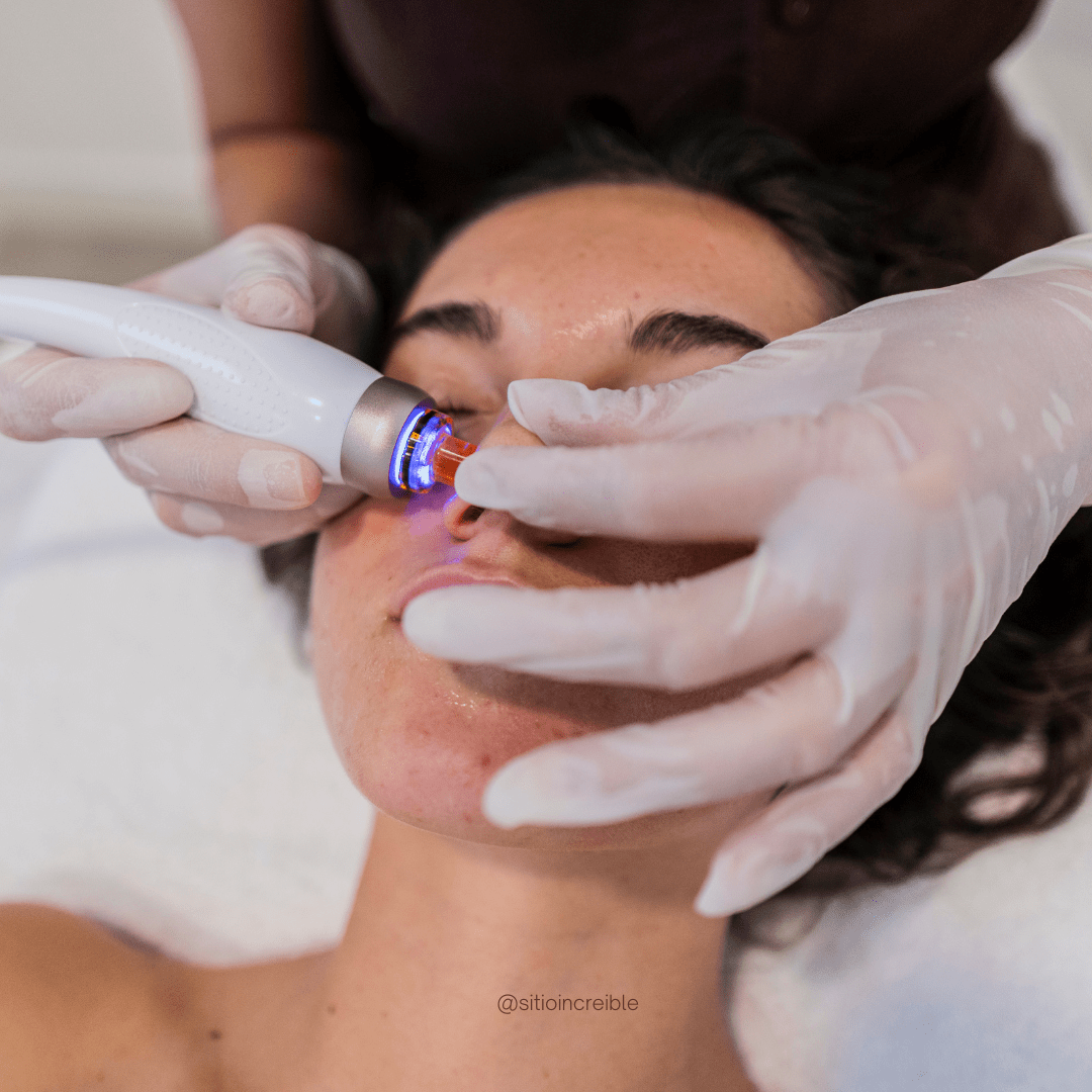 Láser Facial para Manchas Solares: Tratamientos, Beneficios y Resultados en Bogotá