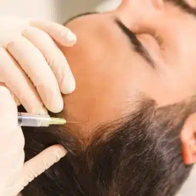 Mesoterapia Capilar Precio en Colombia